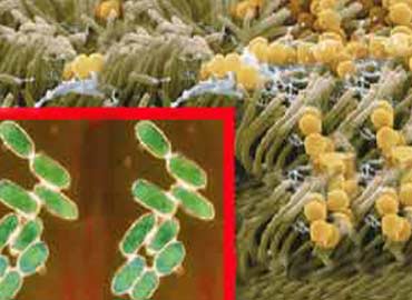 Bacterias de Ántrax infectando a su huésped